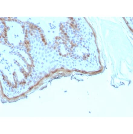Immunohistochemistry - Anti-Filaggrin Antibody [rFLG/1945] - BSA and Azide free (A278474) - Antibodies.com