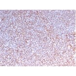 Immunohistochemistry - Anti-ALK Antibody [rALK1/1504] - BSA and Azide free (A278475) - Antibodies.com