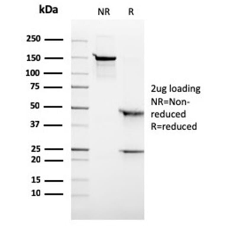 SDS-PAGE - Anti-ALK Antibody [rALK1/1504] - BSA and Azide free (A278475) - Antibodies.com