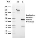 SDS-PAGE - Anti-ALK Antibody [rALK1/1504] - BSA and Azide free (A278475) - Antibodies.com