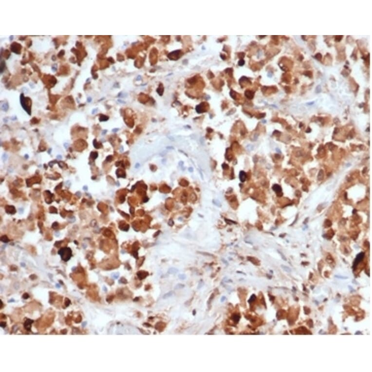 Immunohistochemistry - Anti-Growth Hormone Antibody [rGH/4887] - BSA and Azide free (A278476) - Antibodies.com