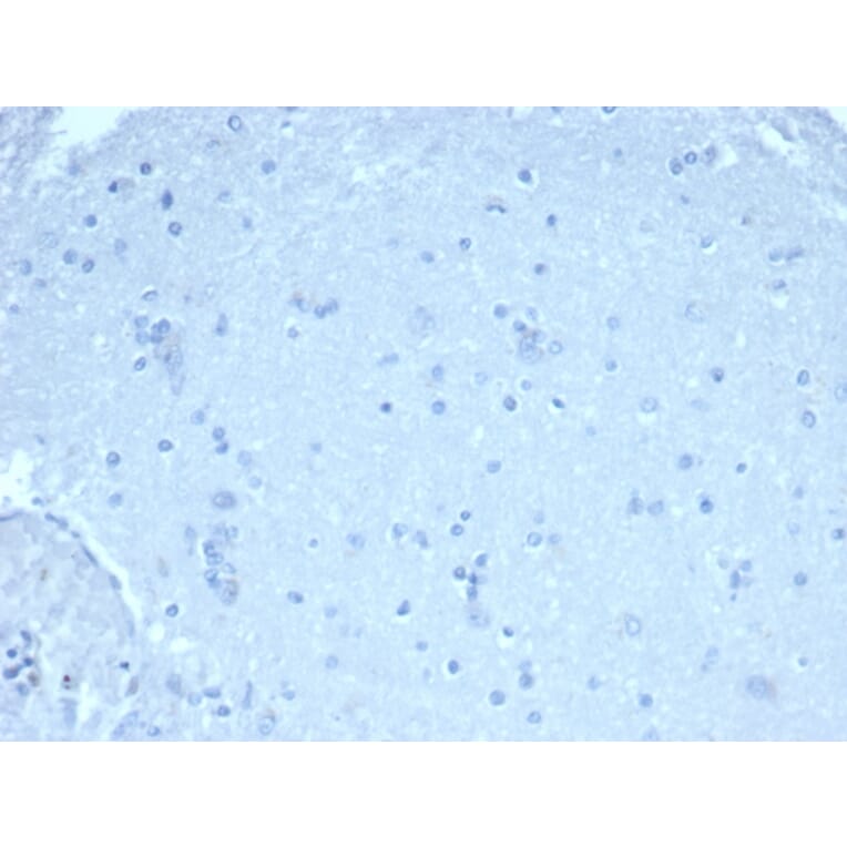 Immunohistochemistry - Anti-FOXP1 Antibody [rFOXP1/6902] - BSA and Azide free (A278477) - Antibodies.com