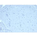 Immunohistochemistry - Anti-FOXP1 Antibody [rFOXP1/6902] - BSA and Azide free (A278477) - Antibodies.com