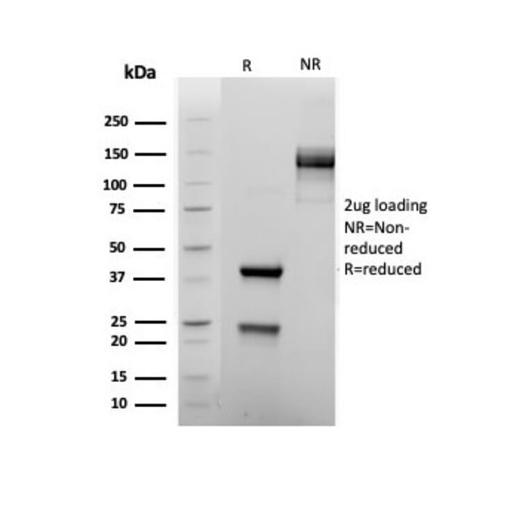SDS-PAGE - Anti-FOXP1 Antibody [rFOXP1/6902] - BSA and Azide free (A278477) - Antibodies.com