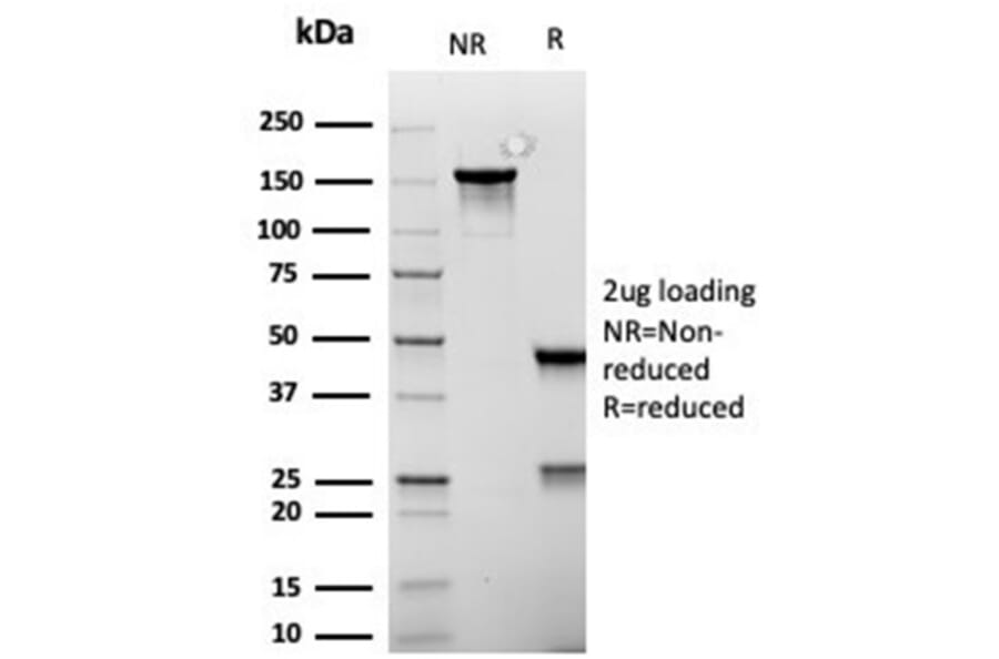 SDS-PAGE - Anti-MSH6 Antibody [rMSH6/6846] - BSA and Azide free (A278478) - Antibodies.com