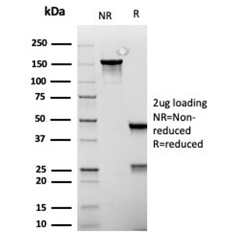 SDS-PAGE - Anti-MSH6 Antibody [rMSH6/6846] - BSA and Azide free (A278478) - Antibodies.com