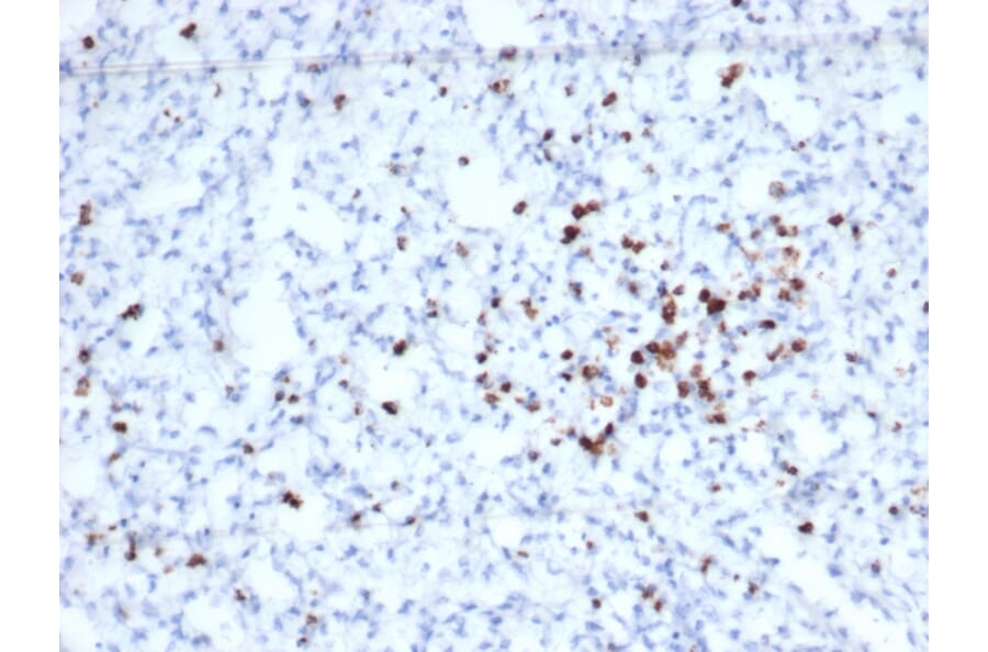 Immunohistochemistry - Anti-Granzyme B Antibody [rGZMB/6740] - BSA and Azide free (A278479) - Antibodies.com