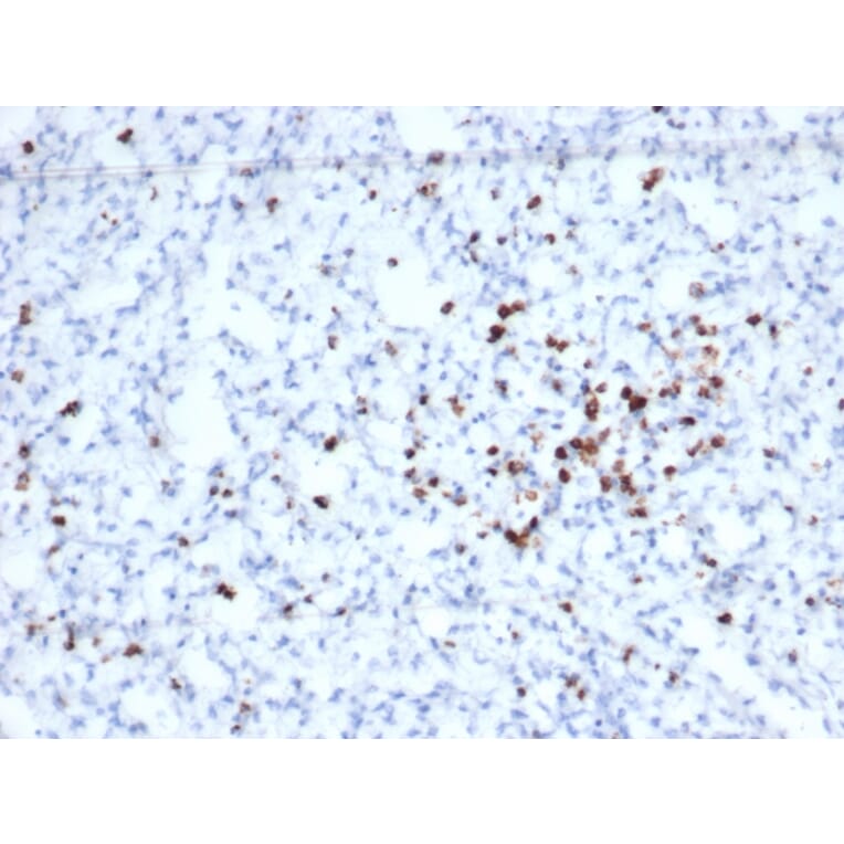 Immunohistochemistry - Anti-Granzyme B Antibody [rGZMB/6740] - BSA and Azide free (A278479) - Antibodies.com