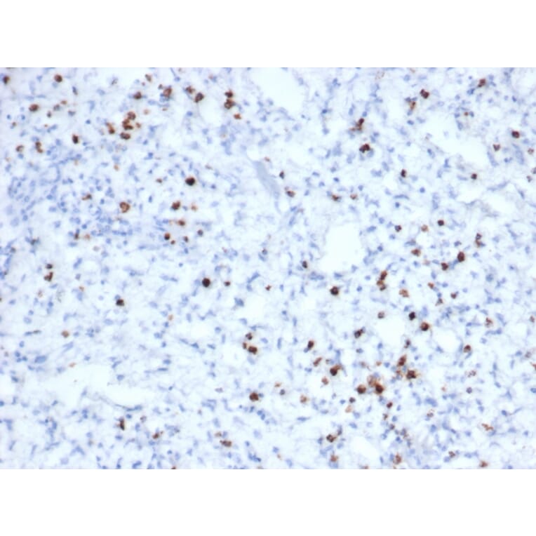 Immunohistochemistry - Anti-Granzyme B Antibody [rGZMB/6740] - BSA and Azide free (A278479) - Antibodies.com