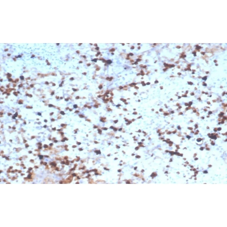 Immunohistochemistry - Anti-Granzyme B Antibody [rGZMB/4538] - BSA and Azide free (A278480) - Antibodies.com