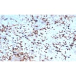 Immunohistochemistry - Anti-Granzyme B Antibody [rGZMB/4538] - BSA and Azide free (A278480) - Antibodies.com