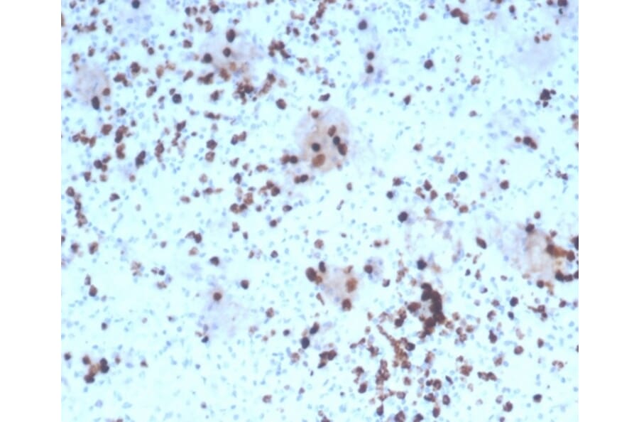 Immunohistochemistry - Anti-Granzyme B Antibody [rGZMB/4538] - BSA and Azide free (A278480) - Antibodies.com