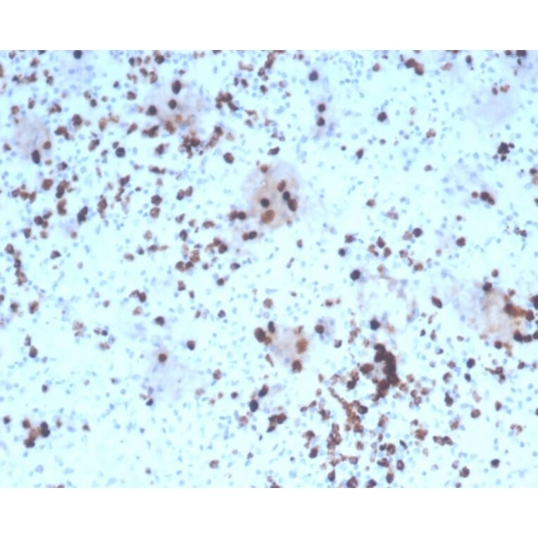 Immunohistochemistry - Anti-Granzyme B Antibody [rGZMB/4538] - BSA and Azide free (A278480) - Antibodies.com