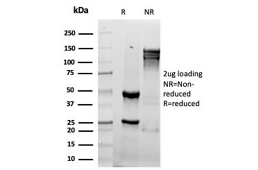 SDS-PAGE - Anti-Granzyme B Antibody [rGZMB/4538] - BSA and Azide free (A278480) - Antibodies.com