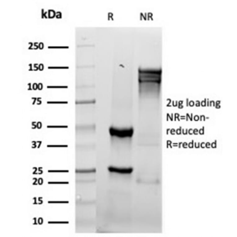 SDS-PAGE - Anti-Granzyme B Antibody [rGZMB/4538] - BSA and Azide free (A278480) - Antibodies.com
