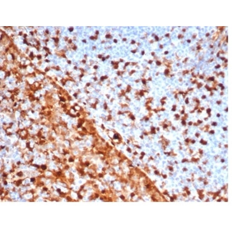 Immunohistochemistry - Anti-Annexin A1 Antibody [rANXA1/6451] - BSA and Azide free (A278481) - Antibodies.com