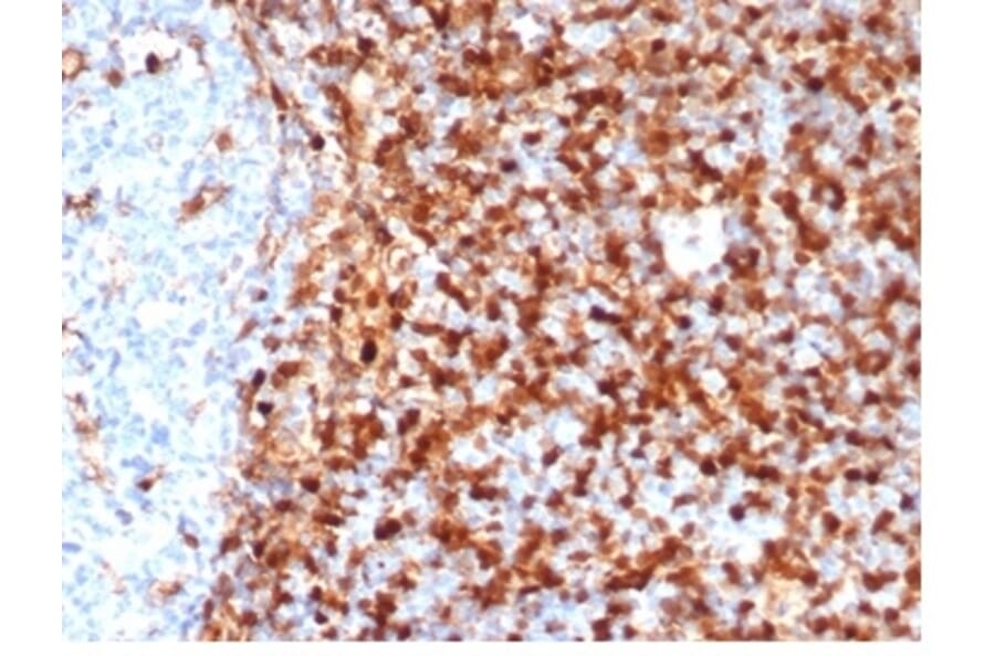 Immunohistochemistry - Anti-Annexin A1 Antibody [rANXA1/6451] - BSA and Azide free (A278481) - Antibodies.com