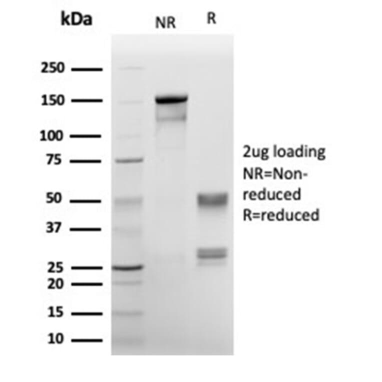 SDS-PAGE - Anti-Annexin A1 Antibody [rANXA1/6451] - BSA and Azide free (A278481) - Antibodies.com