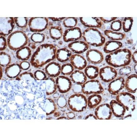 Immunohistochemistry - Anti-HSP60 Antibody [rHSPD1/6497] - BSA and Azide free (A278482) - Antibodies.com