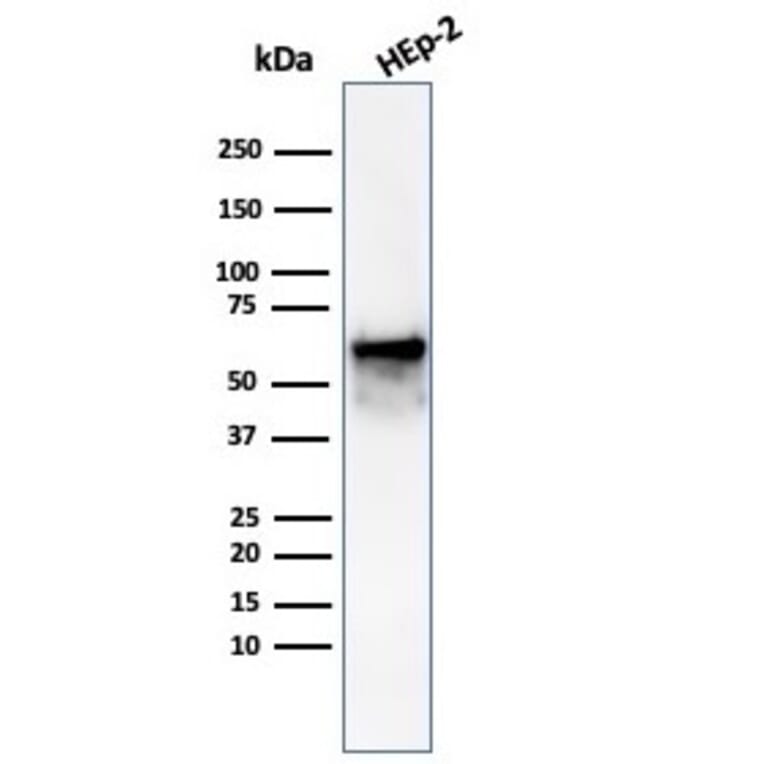 Western Blot - Anti-HSP60 Antibody [rHSPD1/6497] - BSA and Azide free (A278482) - Antibodies.com