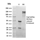 SDS-PAGE - Anti-HSP60 Antibody [rHSPD1/6497] - BSA and Azide free (A278482) - Antibodies.com