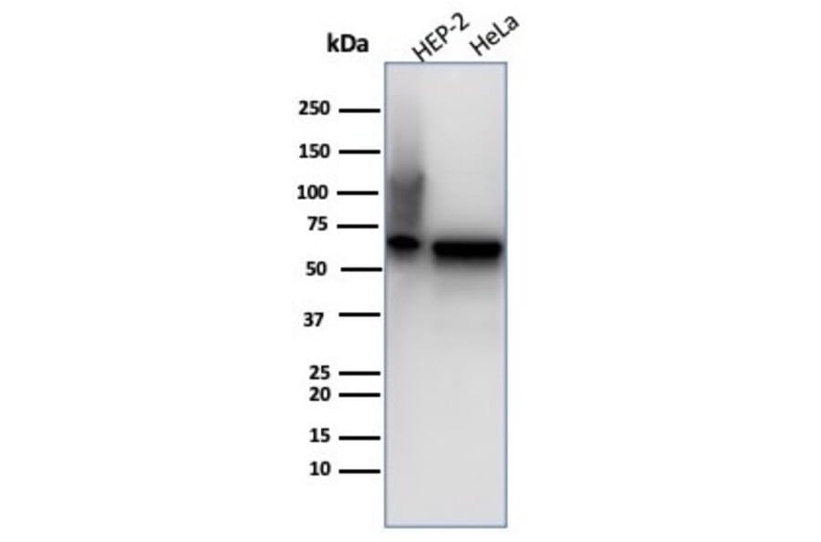 Western Blot - Anti-HSP60 Antibody [rHSPD1/6497] - BSA and Azide free (A278482) - Antibodies.com