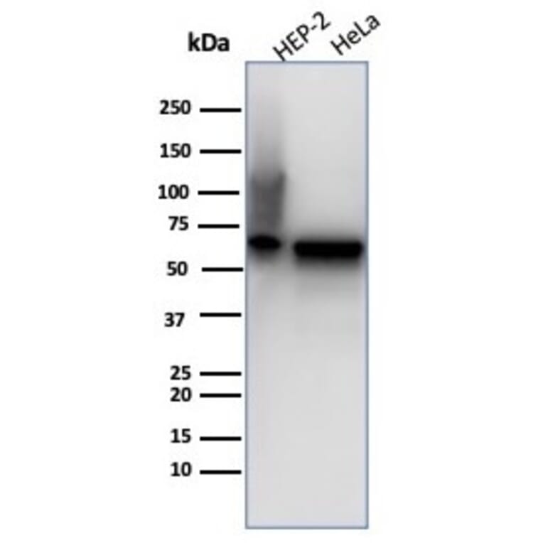 Western Blot - Anti-HSP60 Antibody [rHSPD1/6497] - BSA and Azide free (A278482) - Antibodies.com