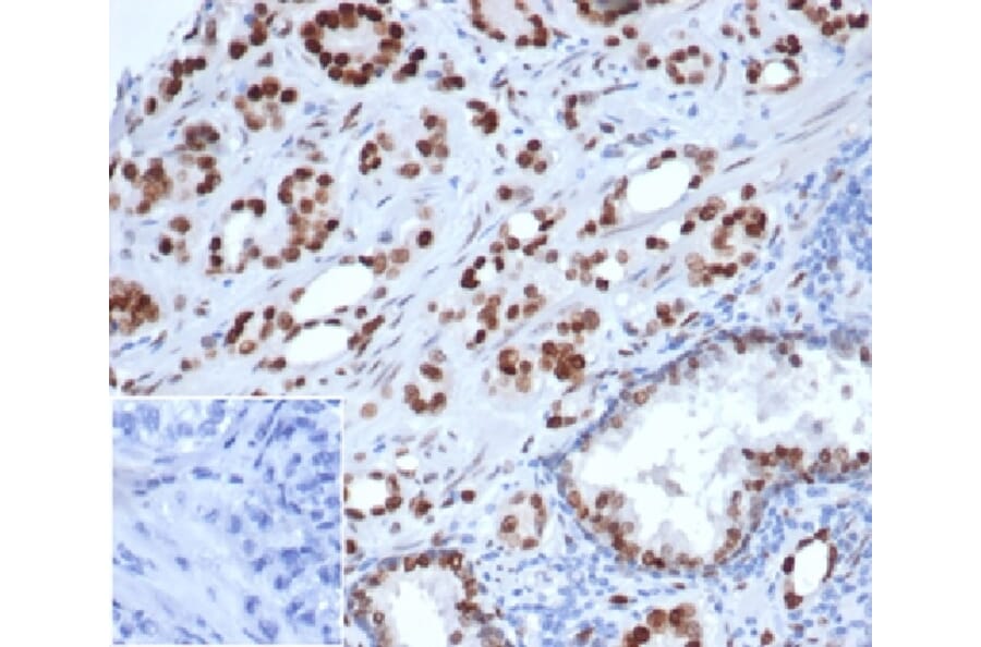 Immunohistochemistry - Anti-Androgen Receptor Antibody [rDHTR/6818] - BSA and Azide free (A278484) - Antibodies.com