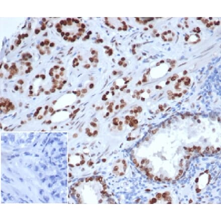 Immunohistochemistry - Anti-Androgen Receptor Antibody [rDHTR/6818] - BSA and Azide free (A278484) - Antibodies.com