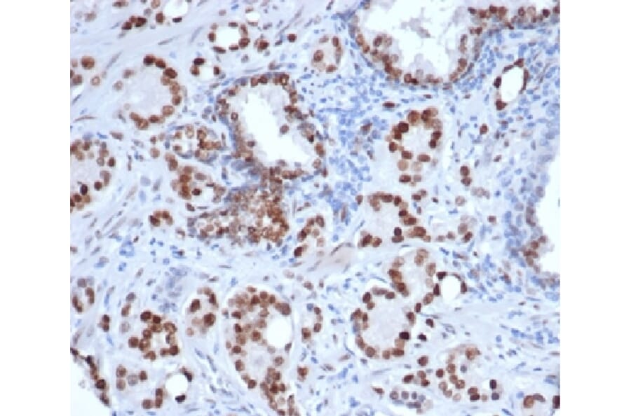 Immunohistochemistry - Anti-Androgen Receptor Antibody [rDHTR/6818] - BSA and Azide free (A278484) - Antibodies.com