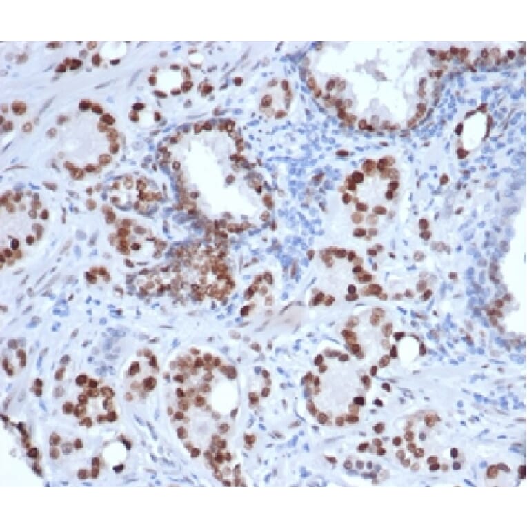 Immunohistochemistry - Anti-Androgen Receptor Antibody [rDHTR/6818] - BSA and Azide free (A278484) - Antibodies.com