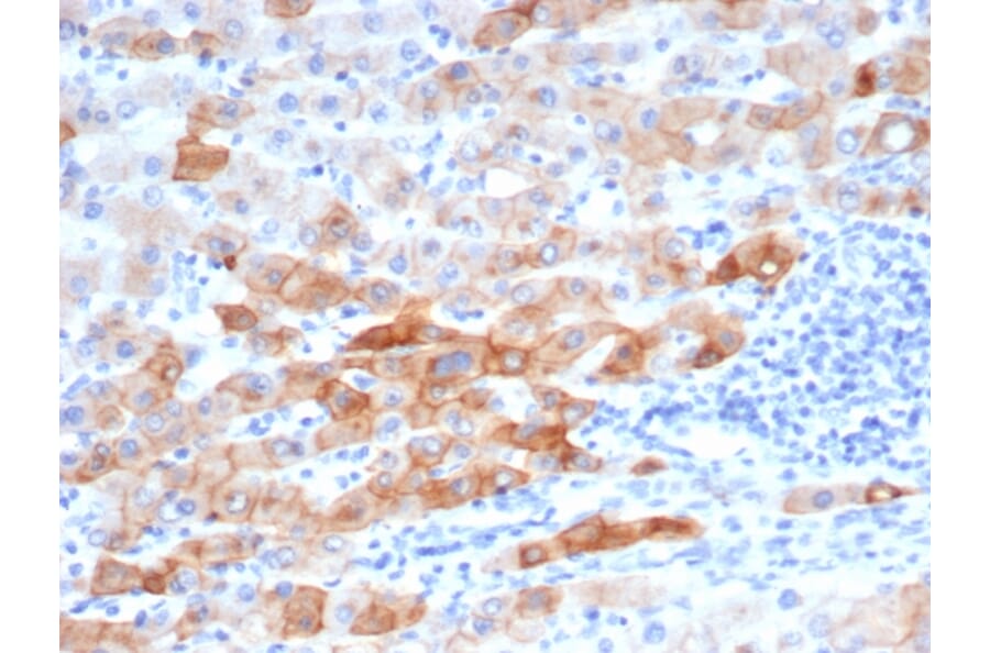 Immunohistochemistry - Anti-Cytokeratin 8 Antibody [rKRT8/6471] - BSA and Azide free (A278485) - Antibodies.com