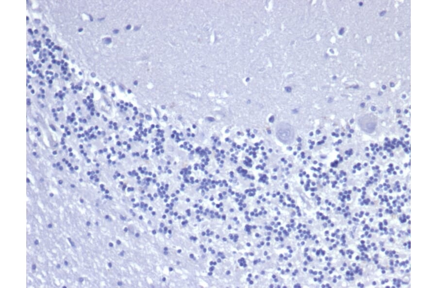 Immunohistochemistry - Anti-Cytokeratin 8 Antibody [rKRT8/6471] - BSA and Azide free (A278485) - Antibodies.com
