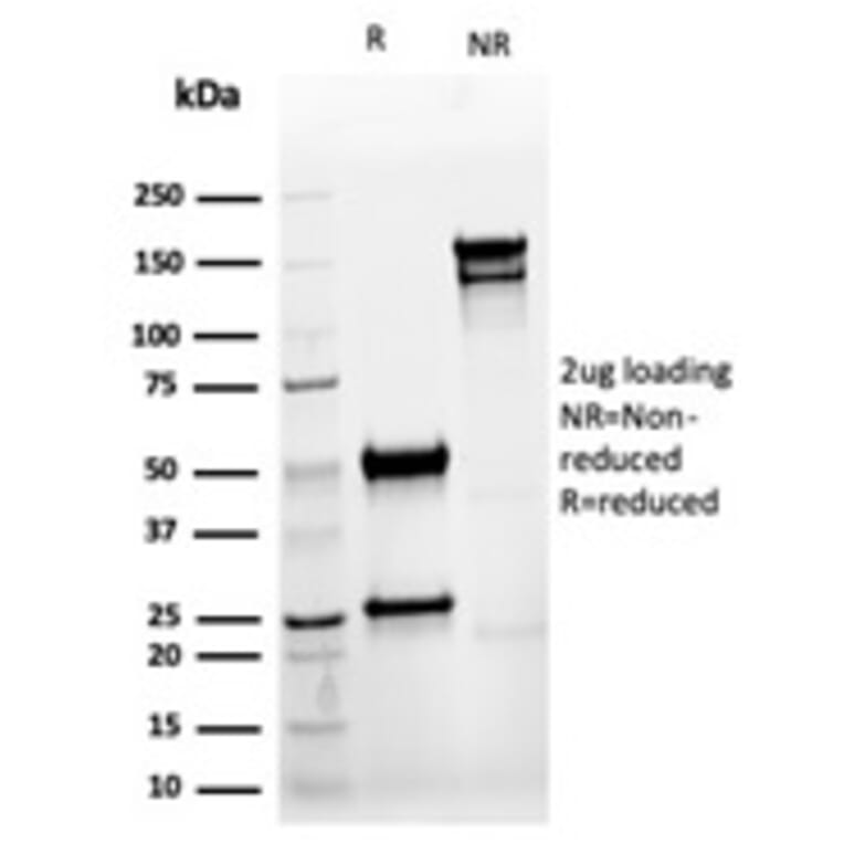 SDS-PAGE - Anti-Cytokeratin 8 Antibody [rKRT8/6471] - BSA and Azide free (A278485) - Antibodies.com