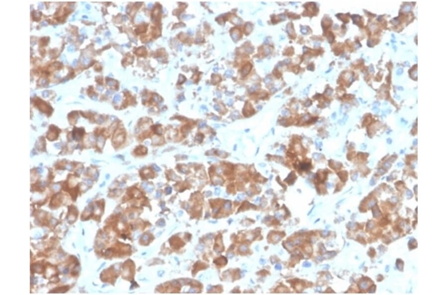 Immunohistochemistry - Anti-Luteinizing Hormone beta Antibody [rLHb/1613] - BSA and Azide free (A278486) - Antibodies.com