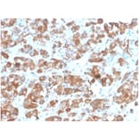 Immunohistochemistry - Anti-Luteinizing Hormone beta Antibody [rLHb/1613] - BSA and Azide free (A278486) - Antibodies.com