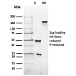 SDS-PAGE - Anti-Luteinizing Hormone beta Antibody [rLHb/1613] - BSA and Azide free (A278486) - Antibodies.com