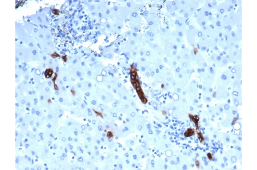 Immunohistochemistry - Anti-TROP2 Antibody [rTACSTD2/6395] - BSA and Azide free (A278487) - Antibodies.com