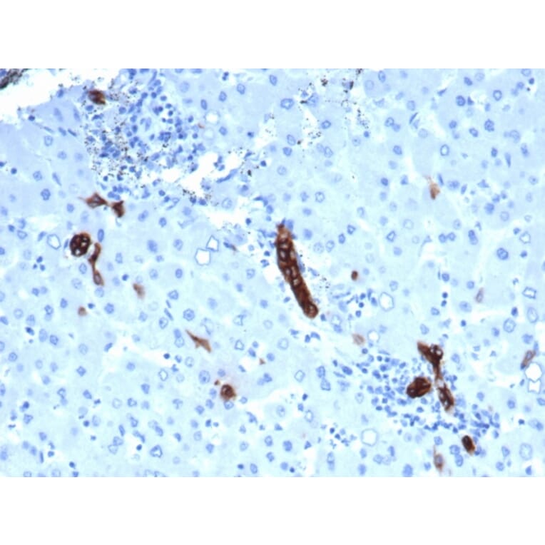 Immunohistochemistry - Anti-TROP2 Antibody [rTACSTD2/6395] - BSA and Azide free (A278487) - Antibodies.com