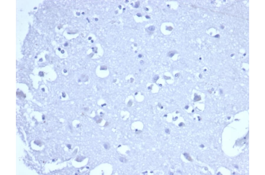 Immunohistochemistry - Anti-TROP2 Antibody [rTACSTD2/6395] - BSA and Azide free (A278487) - Antibodies.com