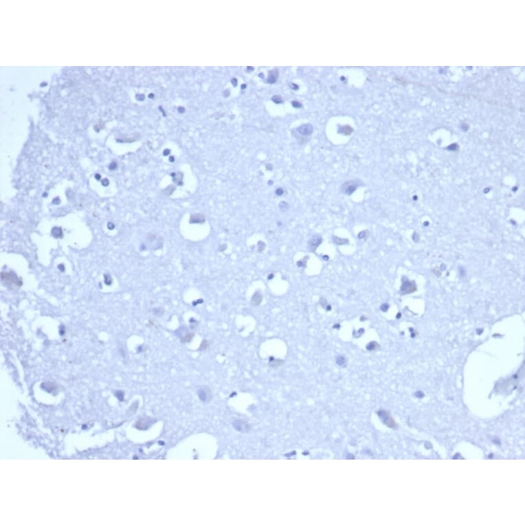 Immunohistochemistry - Anti-TROP2 Antibody [rTACSTD2/6395] - BSA and Azide free (A278487) - Antibodies.com