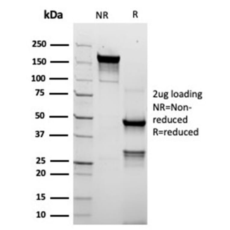 SDS-PAGE - Anti-TROP2 Antibody [rTACSTD2/6395] - BSA and Azide free (A278487) - Antibodies.com