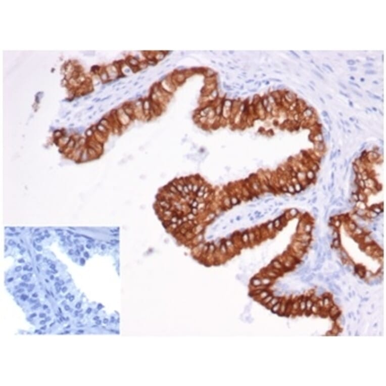 Immunohistochemistry - Anti-EpCAM Antibody [rEGP40/826] - BSA and Azide free (A278488) - Antibodies.com