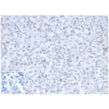 Immunohistochemistry - Anti-MLH1 Antibody [MLH1/6467] - BSA and Azide free (A278489) - Antibodies.com