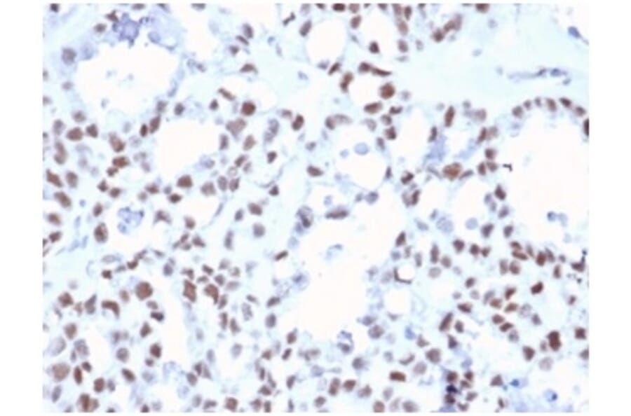 Immunohistochemistry - Anti-MLH1 Antibody [MLH1/6467] - BSA and Azide free (A278489) - Antibodies.com