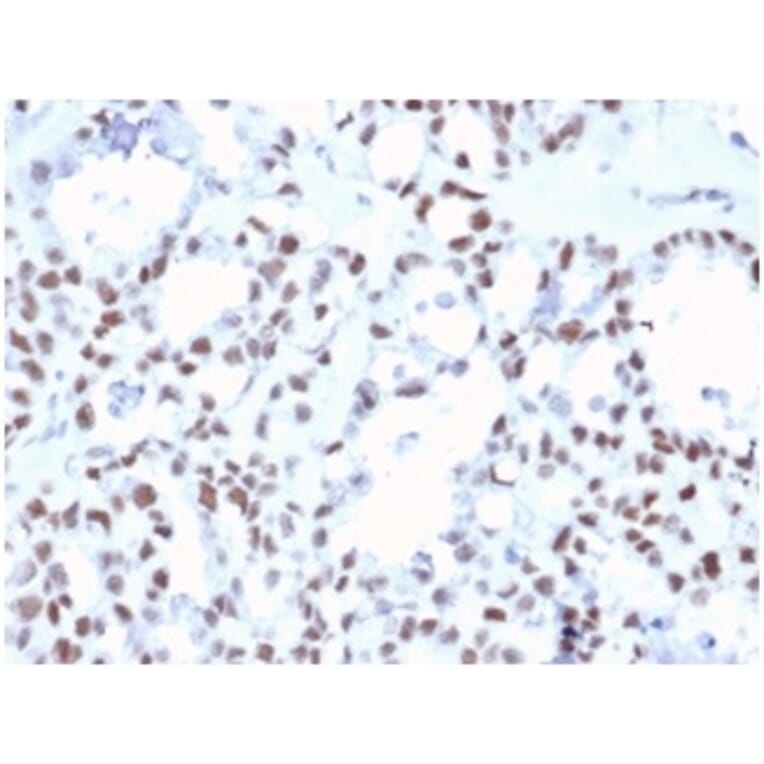 Immunohistochemistry - Anti-MLH1 Antibody [MLH1/6467] - BSA and Azide free (A278489) - Antibodies.com
