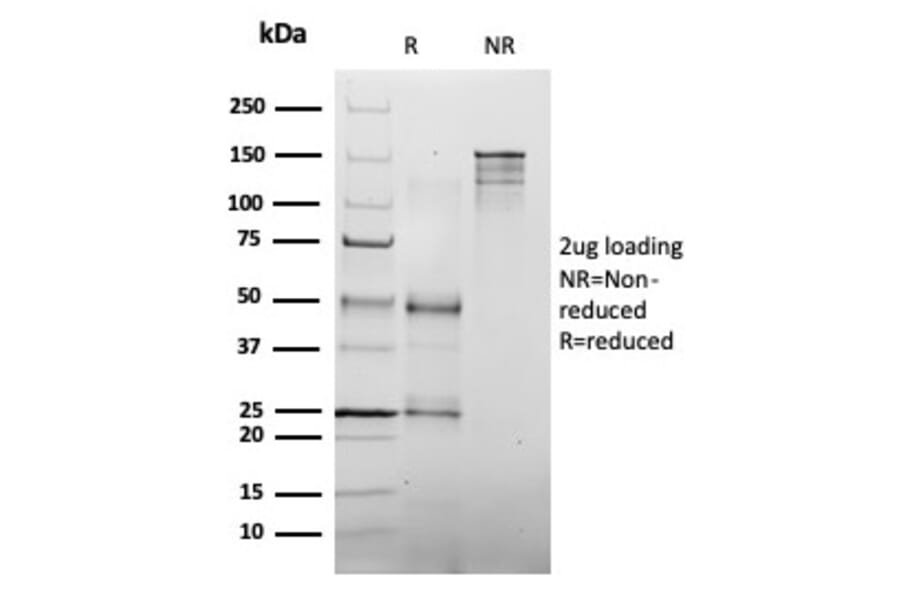 SDS-PAGE - Anti-MLH1 Antibody [MLH1/6467] - BSA and Azide free (A278489) - Antibodies.com