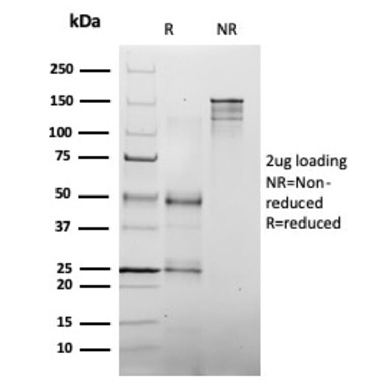 SDS-PAGE - Anti-MLH1 Antibody [MLH1/6467] - BSA and Azide free (A278489) - Antibodies.com