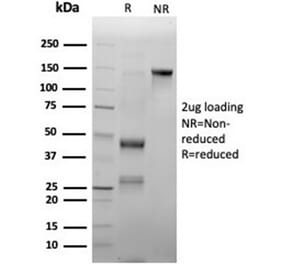 SDS-PAGE - Anti-Myeloperoxidase Antibody [rMPO/6904] - BSA and Azide free (A278490) - Antibodies.com