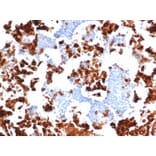 Immunohistochemistry - Anti-Myeloperoxidase Antibody [rMPO/6904] - BSA and Azide free (A278490) - Antibodies.com